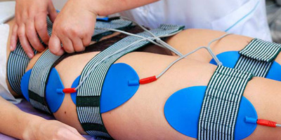 Электронейростимуляция